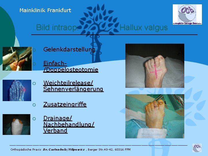 Mainklinik Frankfurt Bild intraop: ¡ Gelenkdarstellung ¡ Einfach/Doppelosteotomie ¡ Weichteilrelease/ Sehnenverlängerung ¡ Zusatzeingriffe ¡