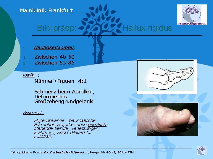 Mainklinik Frankfurt Bild präop: ¡ Häufigkeitsgipfel: 1. Zwischen 40 -50 Zwischen 65 -85 2.