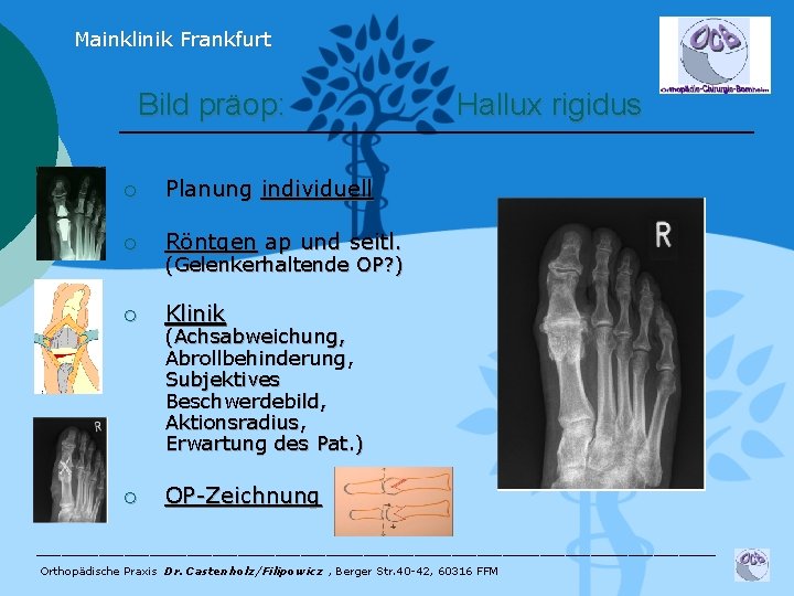 Mainklinik Frankfurt Bild präop: ¡ Planung individuell ¡ Röntgen ap und seitl. ¡ Klinik