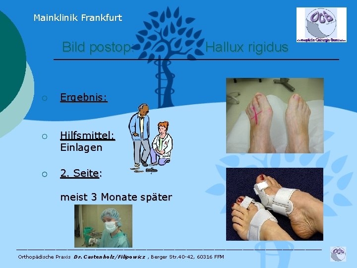 Mainklinik Frankfurt Bild postop: ¡ Ergebnis: ¡ Hilfsmittel: Einlagen ¡ 2. Seite: Hallux rigidus