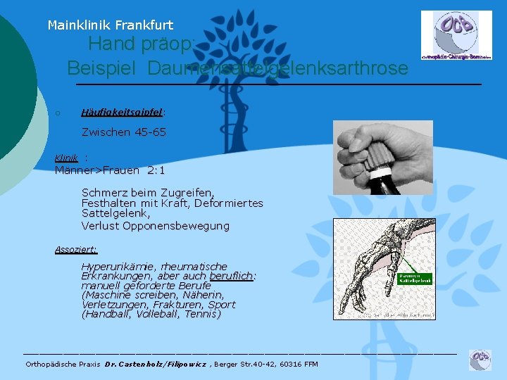 Mainklinik Frankfurt Hand präop: Beispiel Daumensattelgelenksarthrose ¡ Häufigkeitsgipfel: Zwischen 45 -65 : Männer>Frauen 2: