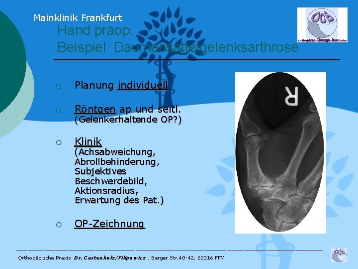 Mainklinik Frankfurt Hand präop: Beispiel Daumensattelgelenksarthrose ¡ Planung individuell ¡ Röntgen ap und seitl.
