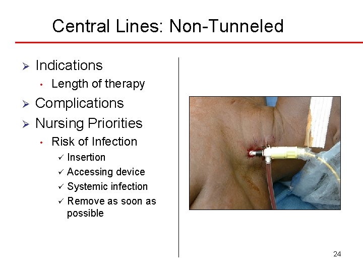 Central Lines: Non-Tunneled Ø Indications • Ø Ø Length of therapy Complications Nursing Priorities