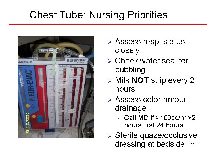 Chest Tube: Nursing Priorities Ø Ø Assess resp. status closely Check water seal for