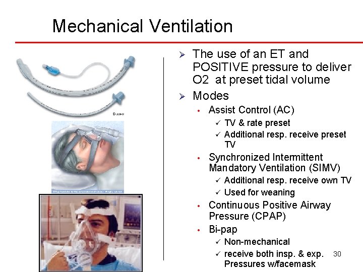 Mechanical Ventilation Ø Ø The use of an ET and POSITIVE pressure to deliver