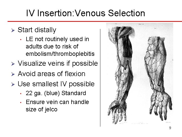 IV Insertion: Venous Selection Ø Start distally • Ø Ø Ø LE not routinely