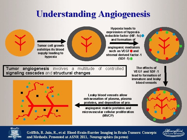 Understanding Angiogenesis Hypoxia leads to expression of hypoxiainducible factor (HIF-1α) and formation of Tumor