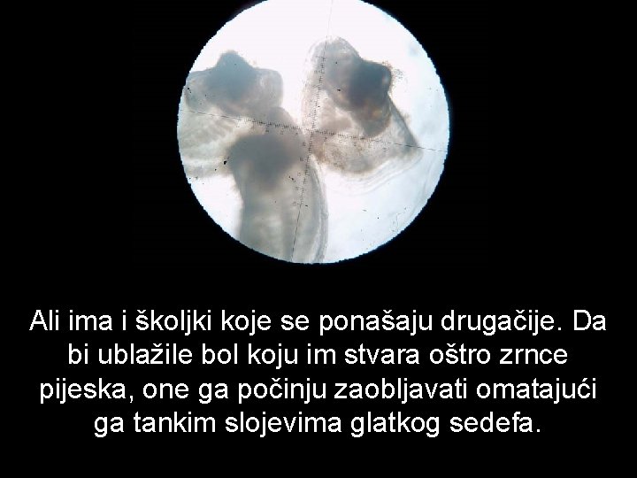 Ali ima i školjki koje se ponašaju drugačije. Da bi ublažile bol koju im