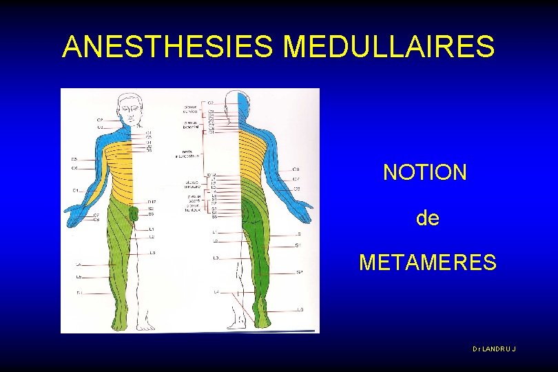 ANESTHESIES MEDULLAIRES NOTION de METAMERES Dr LANDRU J 
