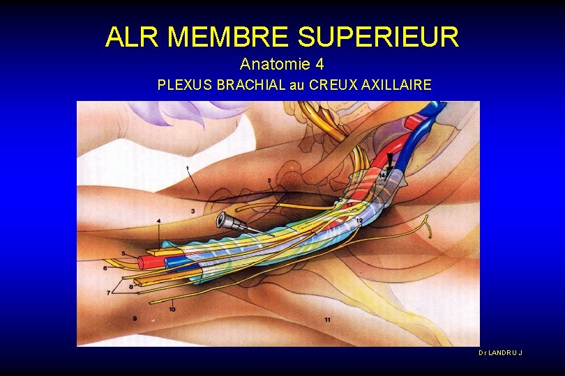 ALR MEMBRE SUPERIEUR Anatomie 4 PLEXUS BRACHIAL au CREUX AXILLAIRE Dr LANDRU J 