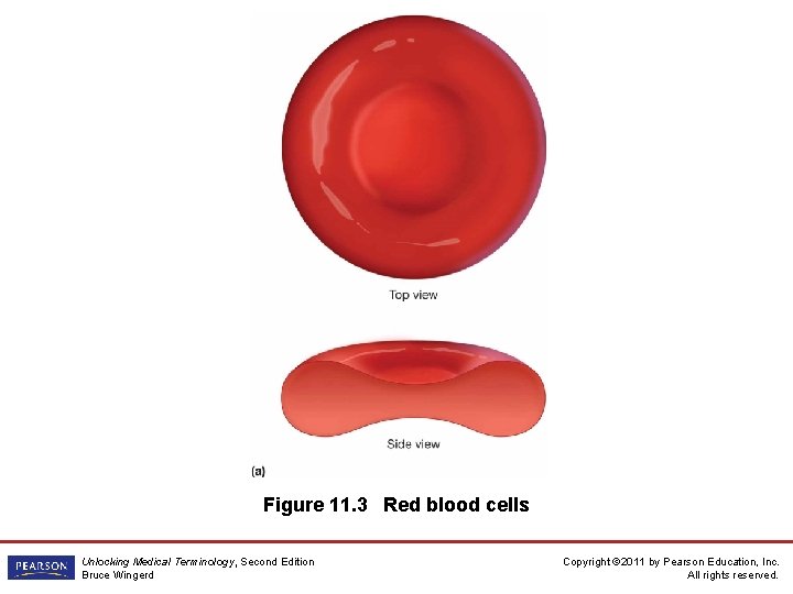 Figure 11. 3 Red blood cells Unlocking Medical Terminology, Second Edition Bruce Wingerd Copyright