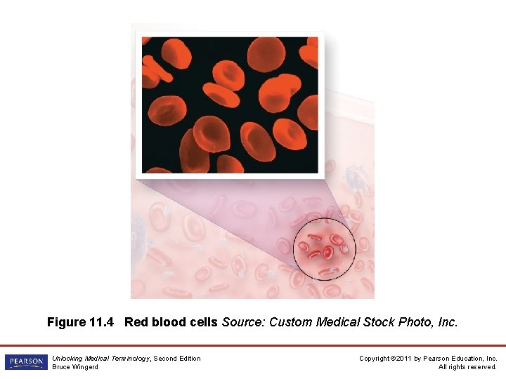 Figure 11. 4 Red blood cells Source: Custom Medical Stock Photo, Inc. Unlocking Medical