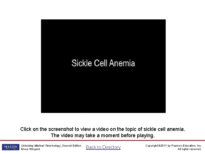 Sickle Cell Video Click on the screenshot to view a video on the topic