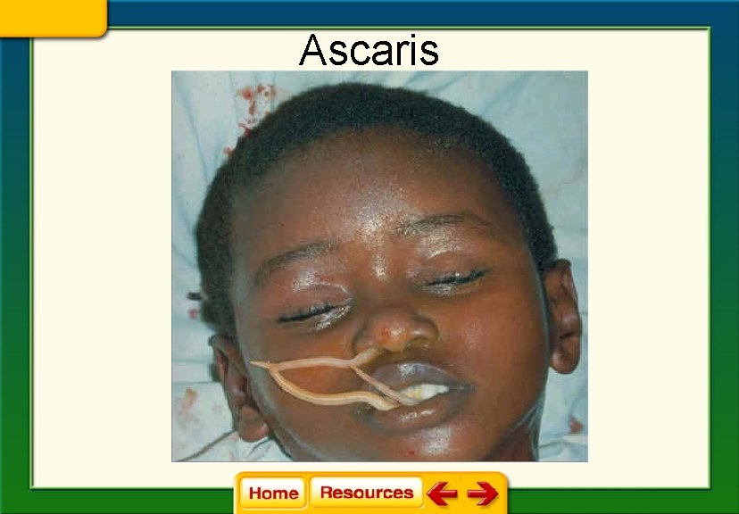 Ascaris 