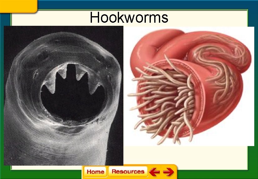 Hookworms 