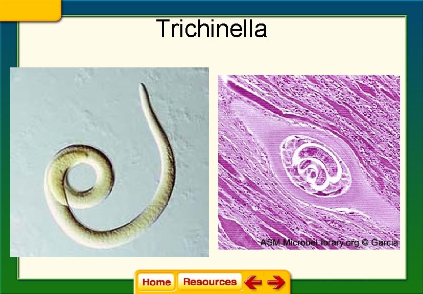 Trichinella 