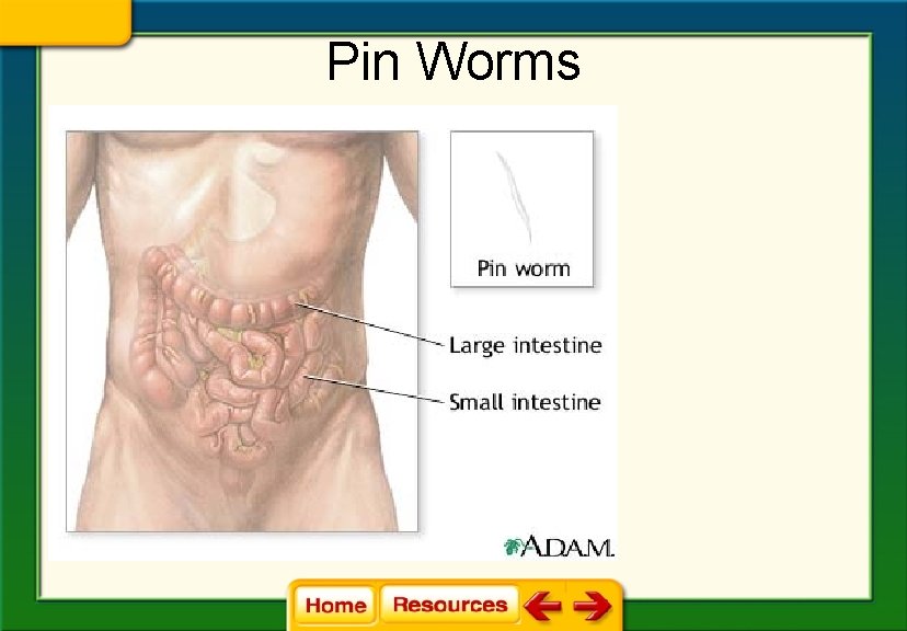 Pin Worms 