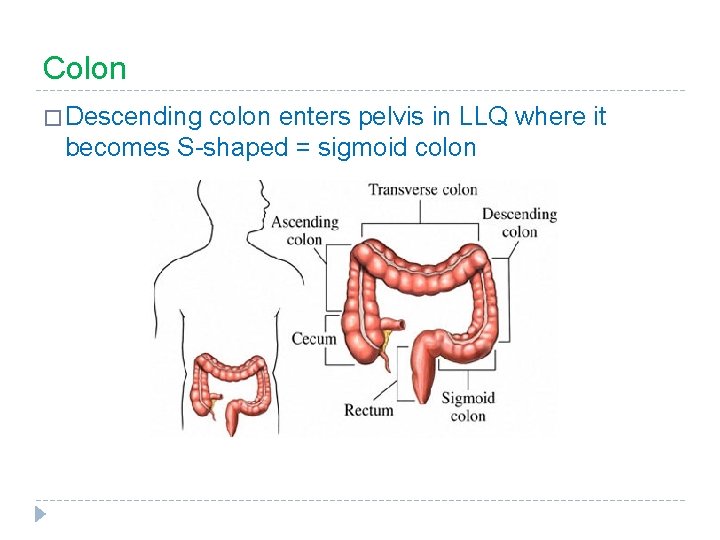 Colon � Descending colon enters pelvis in LLQ where it becomes S-shaped = sigmoid