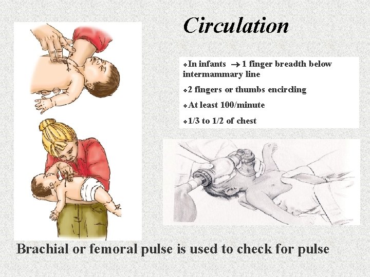 Circulation In infants 1 finger breadth below intermammary line v 2 fingers or thumbs