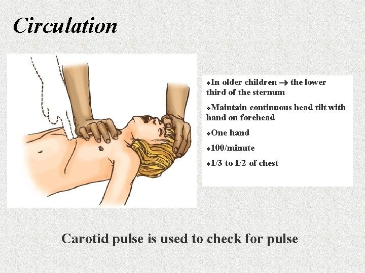 Circulation In older children the lower third of the sternum v Maintain continuous head