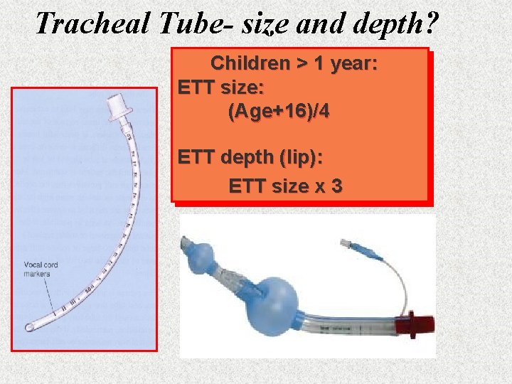 Tracheal Tube- size and depth? Children > 1 year: ETT size: (Age+16)/4 ETT depth