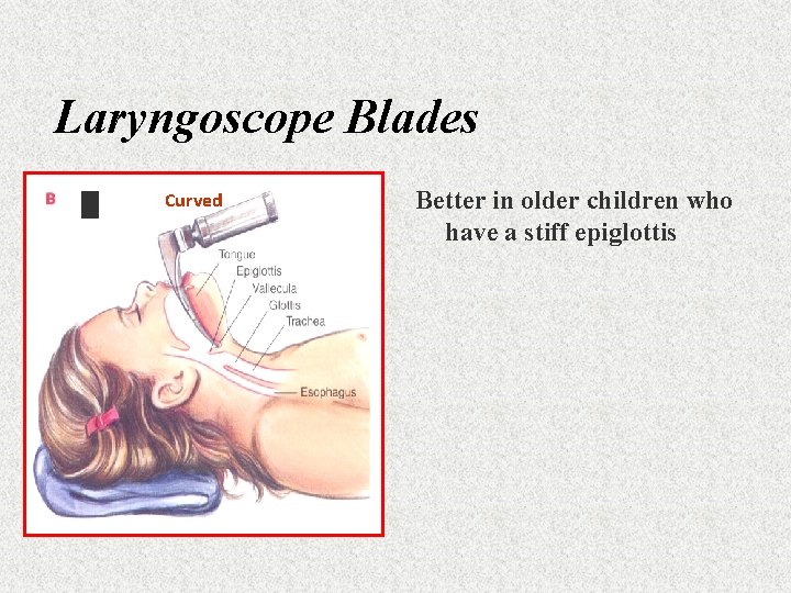 Laryngoscope Blades Curved Better in older children who have a stiff epiglottis 