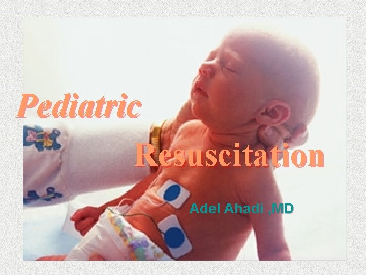 Pediatric Resuscitation Adel Ahadi , MD 