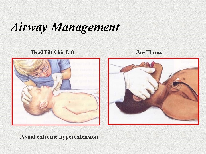 Airway Management Head Tilt-Chin Lift Avoid extreme hyperextension Jaw Thrust 