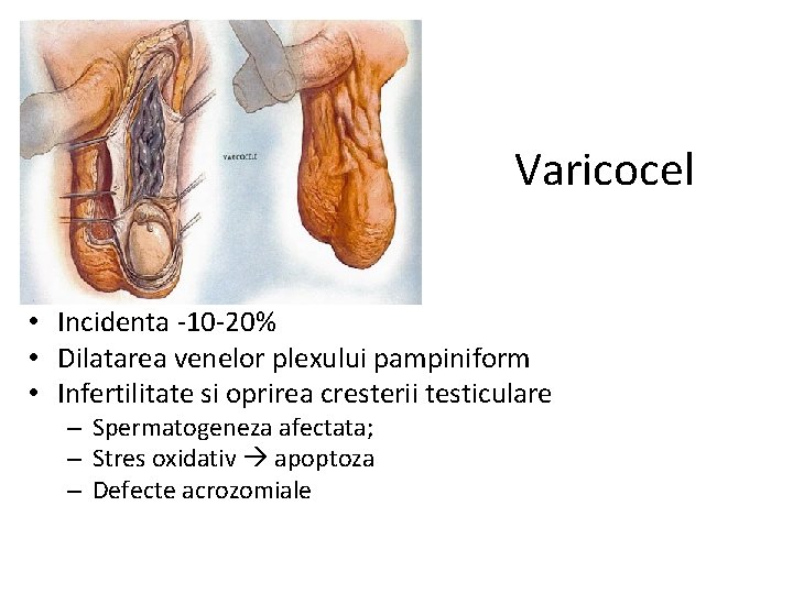 remedii populare pentru tratamentul adenomului de prostată psa marit ce inseamna