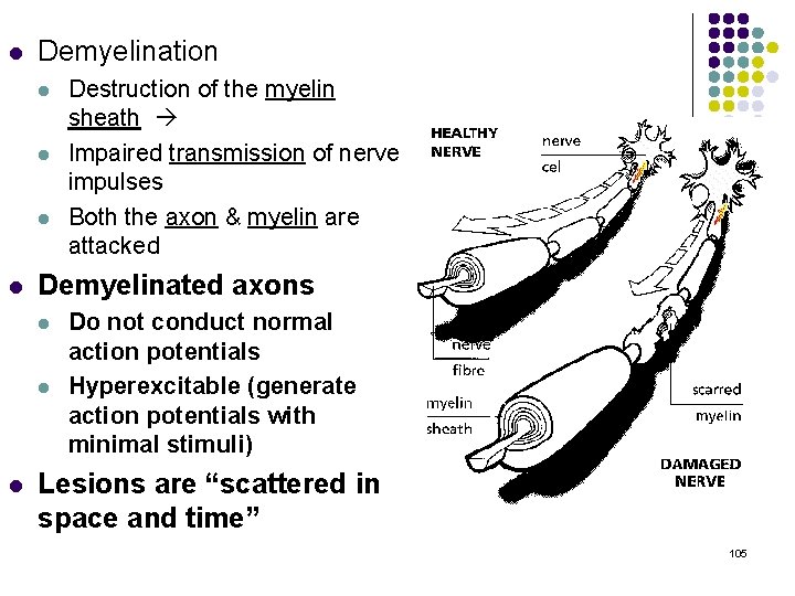 l Demyelination l l Demyelinated axons l l l Destruction of the myelin sheath