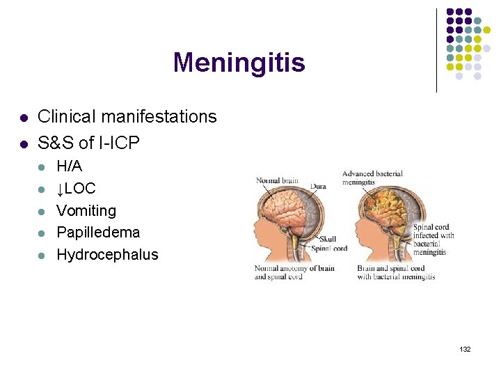 Meningitis l l Clinical manifestations S&S of I-ICP l l l H/A ↓LOC Vomiting