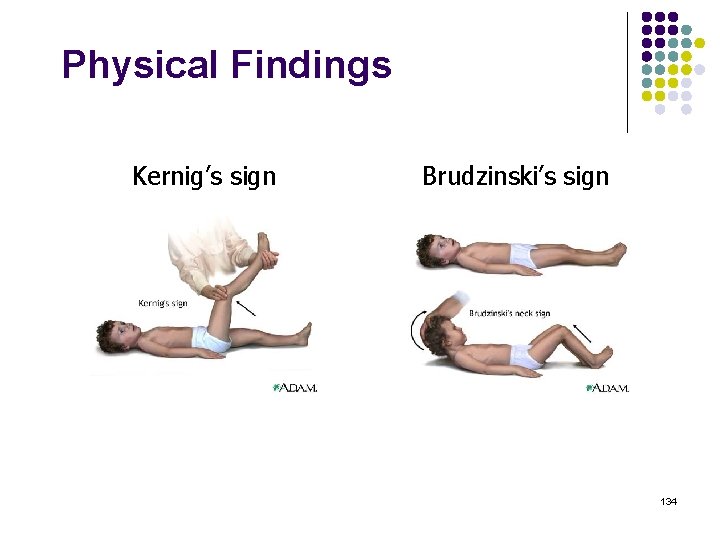 Physical Findings Kernig’s sign Brudzinski’s sign 134 