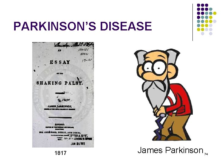 PARKINSON’S DISEASE 1817 James Parkinson 74 