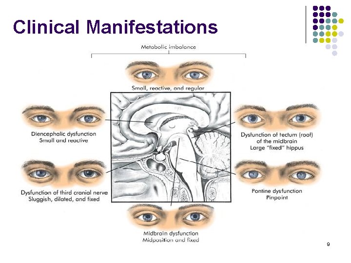 Clinical Manifestations 9 