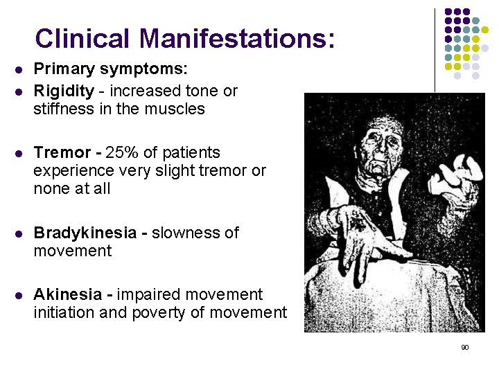 Clinical Manifestations: l l Primary symptoms: Rigidity - increased tone or stiffness in the