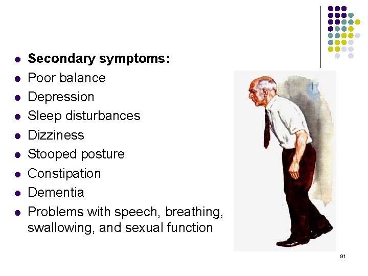 l l l l l Secondary symptoms: Poor balance Depression Sleep disturbances Dizziness Stooped