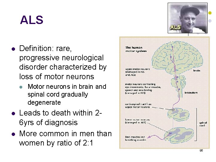 ALS l Definition: rare, progressive neurological disorder characterized by loss of motor neurons l