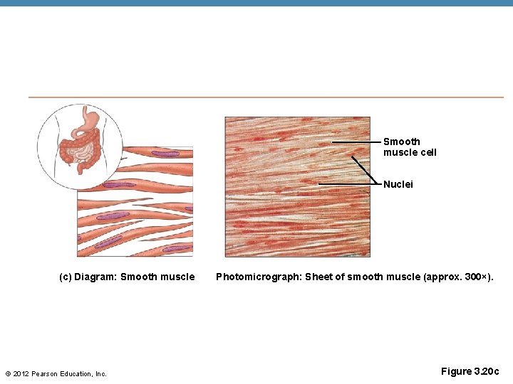 Smooth muscle cell Nuclei (c) Diagram: Smooth muscle © 2012 Pearson Education, Inc. Photomicrograph: