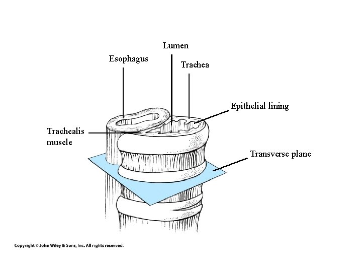 Lumen Esophagus Trachea Epithelial lining Trachealis muscle Transverse plane 