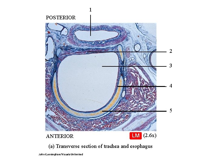 1 POSTERIOR 2 3 4 5 ANTERIOR LM (2. 6 x) (a) Transverse section