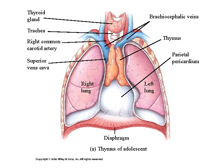 Thyroid gland Brachiocephalic veins Trachea Thymus Right common carotid artery Parietal pericardium Superior vena