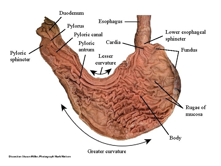Duodenum Esophagus Pyloric canal Pyloric sphincter Pyloric antrum Cardia Lower esophageal sphincter Fundus Lesser