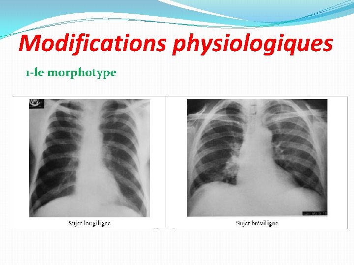 Modifications physiologiques 1 -le morphotype 