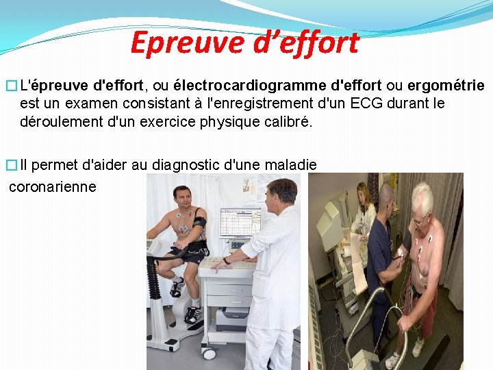 Epreuve d’effort �L'épreuve d'effort, ou électrocardiogramme d'effort ou ergométrie est un examen consistant à