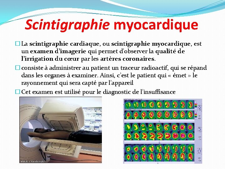 Scintigraphie myocardique � La scintigraphie cardiaque, ou scintigraphie myocardique, est un examen d’imagerie qui