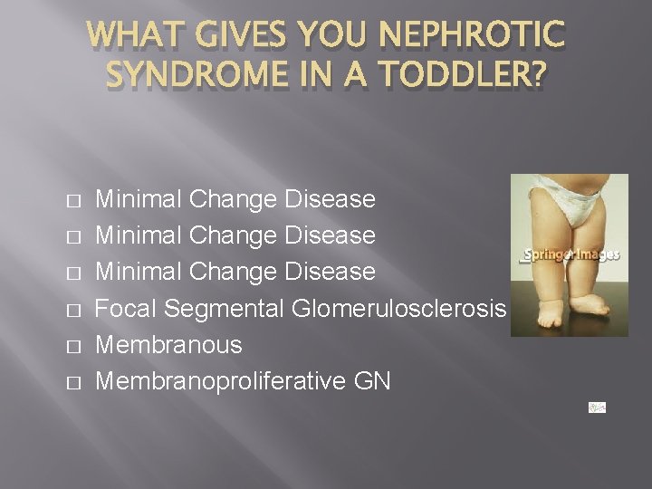 WHAT GIVES YOU NEPHROTIC SYNDROME IN A TODDLER? � � � Minimal Change Disease