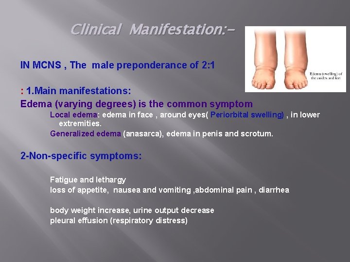 Clinical Manifestation: IN MCNS , The male preponderance of 2: 1 : 1. Main
