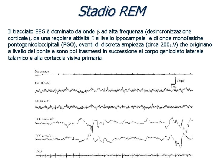 Stadio REM Il tracciato EEG è dominato da onde b ad alta frequenza (desincronizzazione
