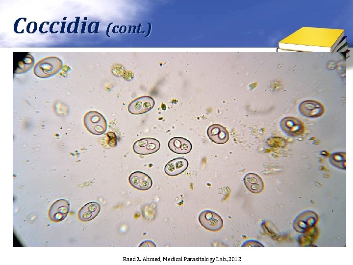 Coccidia (cont. ) Raed Z. Ahmed, Medical Parasitology Lab. , 2012 