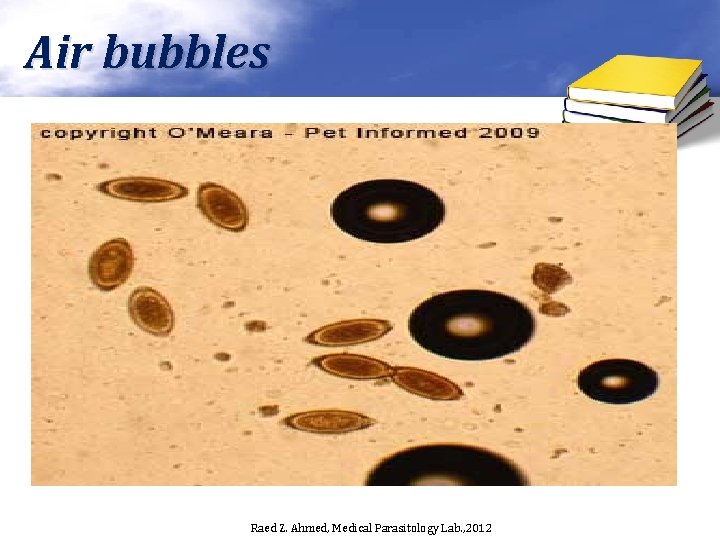 Air bubbles Raed Z. Ahmed, Medical Parasitology Lab. , 2012 